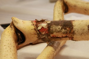 Some of the old filler material in a leg