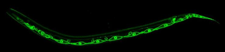 Stem cells visible inside a worm