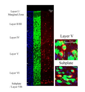 Neurons under the microscope