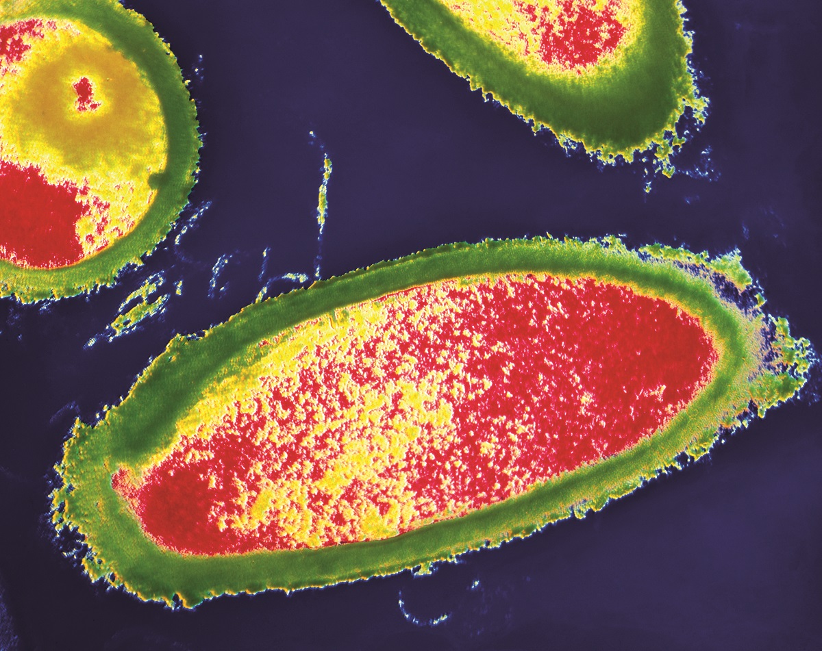 Bacteria that changed the world: Lactobacillus acidophilus – More