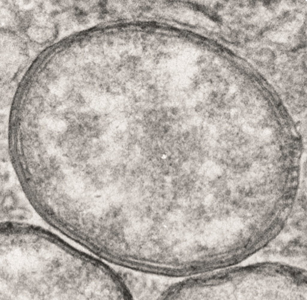 BACTERIA / WOMB Ⅱ RECORDED AT NOAH top-ten-no.5_-wolbachia_steven