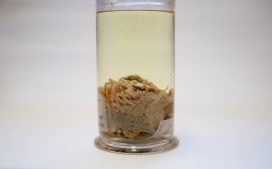 Close up of OUMNH-ZC-7483 Section of blue whale intestine with mysterious acanthocephalan parasites