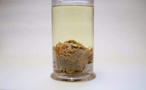 Close up of OUMNH-ZC-7483 Section of blue whale intestine with mysterious acanthocephalan parasites